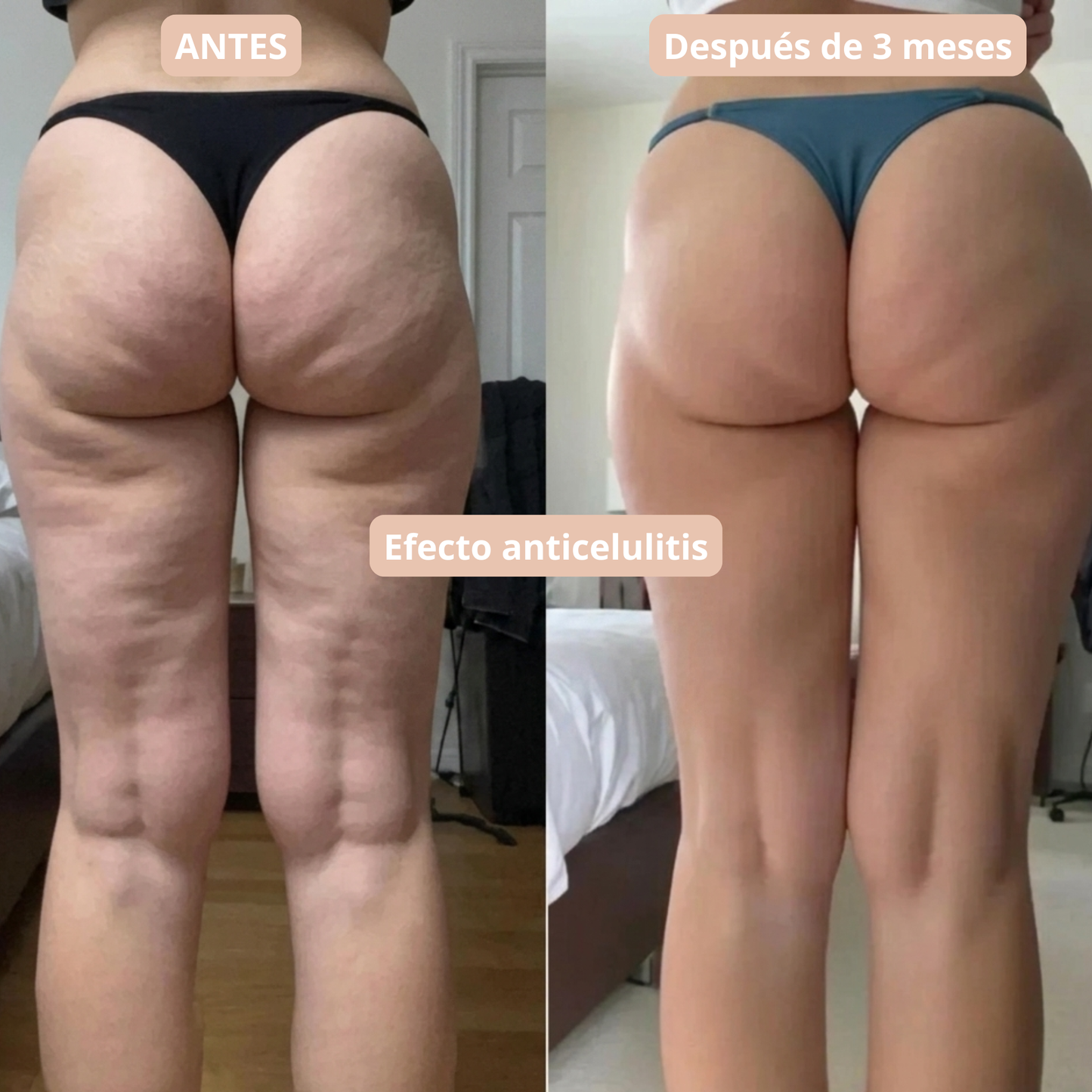 Leggings 3D VidaLiviana: redefine tu silueta sin esfuerzo.