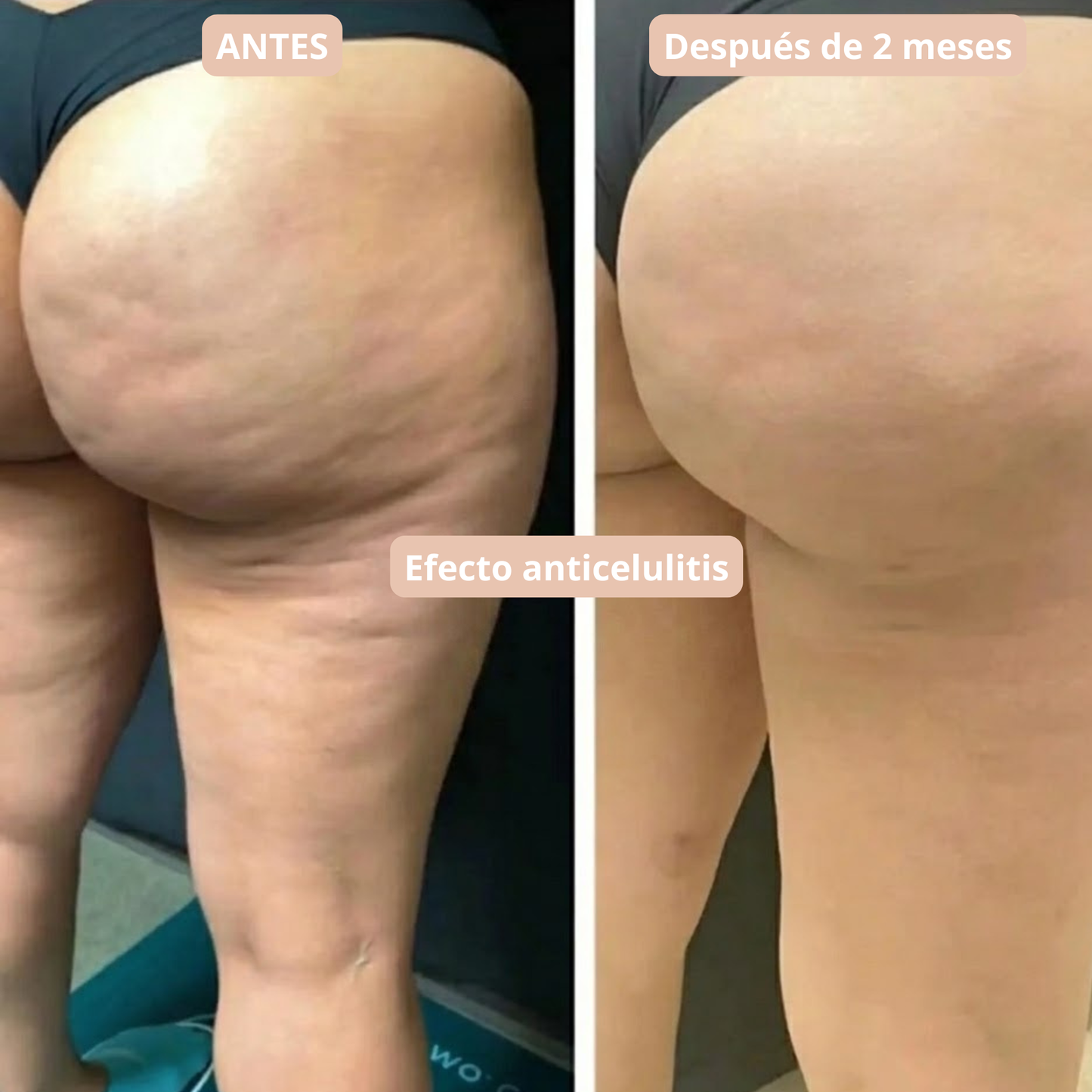 Leggings 3D VidaLiviana: redefine tu silueta sin esfuerzo.